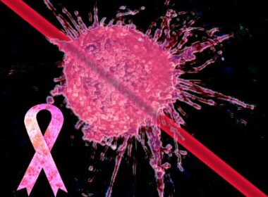 التريهالوز - علاج سرطان الثدي